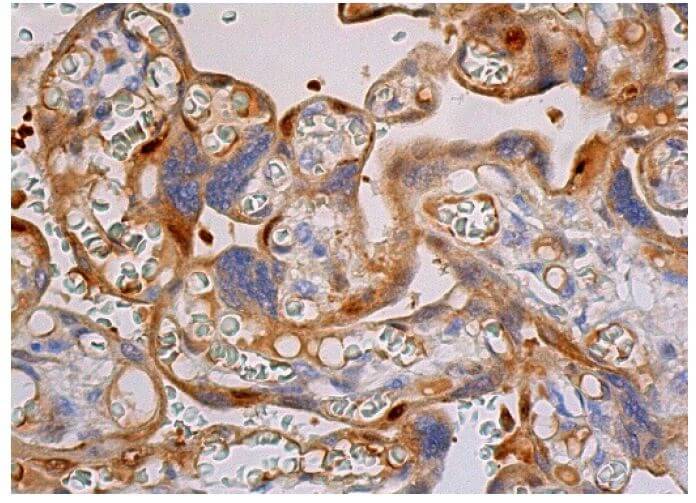 tlr4-antibody-25- tlr4-antibody-25-