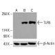 TLR5 Antibody (C7) - Western Blotting - Image 416461