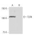 TLR8 Antibody (9A6) - Western Blotting - Image 65077