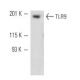 TLR9 Antibody (5G5) - Western Blotting - Image 11051