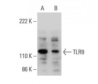 western blotting image from recommended TLR9 (F-3) monoclonal antibody replacement. Image 377906