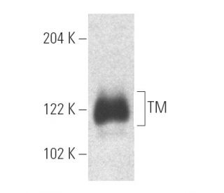 western blotting image from recommended TM (D-3) monoclonal antibody replacement. Image 4972