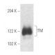 western blotting image from recommended TM (D-3) monoclonal antibody replacement. Image 4972
