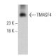 TM4SF4 Antibody (4E6) - Western Blotting - Image 384271 