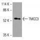 TMCC3 Antibody (D-6) - Western Blotting - Image 416050