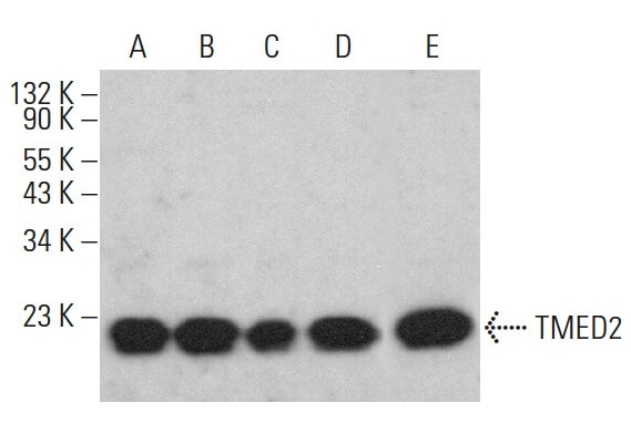 TMED2 Antibody (E-12) | SCBT - Santa Cruz Biotechnology