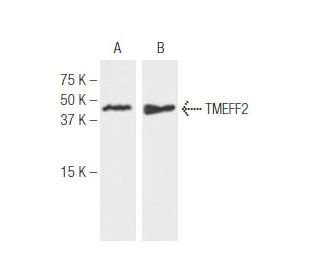 TMEFF2 Antibody (J4B6) - Western Blotting - Image 62772