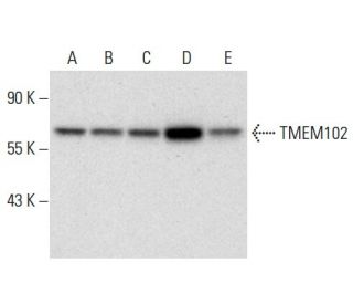 TMEM102 Antibody (F-11) - Western Blotting - Image 304495 