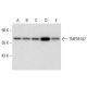 TMEM102 Antibody (F-11) - Western Blotting - Image 304495 