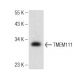 TMEM111 Antibody (F-10) - Western Blotting - Image 147362