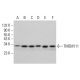 TMEM111 Antibody (F-10) - Western Blotting - Image 382864 