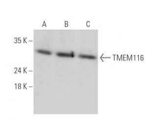 TMEM116 Antibody (B-3) - Western Blotting - Image 346493 