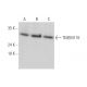 TMEM116 Antibody (B-3) - Western Blotting - Image 346493 