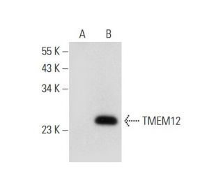 TMEM12 Antibody (D-2) - Western Blotting - Image 311963