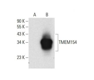 TMEM154 Antibody (F-8) - Western Blotting - Image 308436