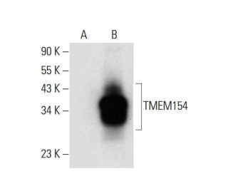 TMEM154 Antibody (H-11) - Western Blotting - Image 308434 