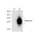 TMEM154 Antibody (H-11) - Western Blotting - Image 308434 