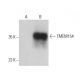 TMEM154 Antibody (H-11) - Western Blotting - Image 397610