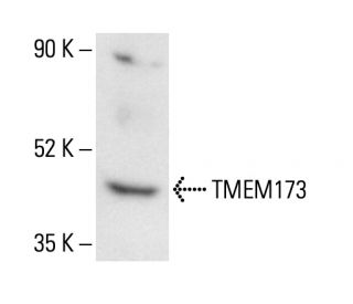 TMEM173 Antibody (C-10) - Western Blotting - Image 404795