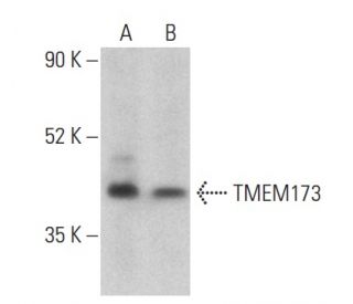 TMEM173 Antibody (C-10) - Western Blotting - Image 399467