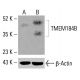 TMEM184B Antibody (A-6): sc-515425. Western blot analysis of TMEM184B expression in untreated (A) and chemically-treated (B) HeLa whole cell lysates. β-Actin (C4): sc-47778 used as loading control. Detection reagent used: m-IgG Fc BP-HRP: sc-525409. TMEM184B Antibody (A-6) - Western Blotting - Image 416004