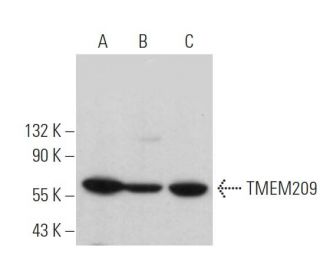 TMEM209 Antibody (F-5) - Western Blotting - Image 371066 