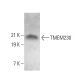 TMEM230 Antibody (G-2) - Western Blotting - Image 368971