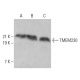 TMEM230 Antibody (G-2) - Western Blotting - Image 368975 