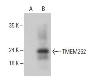 TMEM252 Antibody (H-4) - Western Blotting - Image 333491
