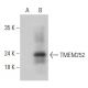 TMEM252 Antibody (H-4) - Western Blotting - Image 333491