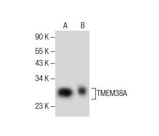 Anti-TMEM38A Antibody (G-12) | SCBT - Santa Cruz Biotechnology