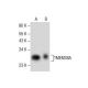 TMEM38A Antibody (G-12) - Western Blotting - Image 285421 