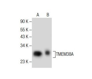 TMEM38A Antibody (G-12) - Western Blotting - Image 285421The Double Nickase Plasmid features a U6 promoter for sgRNA expression, a 20 nt targeting sequence, and a gRNA scaffold to guide Cas9n. It includes a CBh promoter for Cas9n (D10A) and puromycin resistance, GFP for transfection verification, and nuclear localization signals (NLS). The 2A peptide allows co-expression of Cas9n and Puro from a single promoter, enabling precise genome editing with reduced off-target effects.