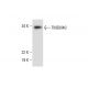TMEM40 Antibody (A-9) - Western Blotting - Image 297064