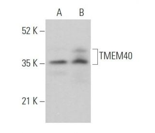 TMEM40 Antibody (A-9) - Western Blotting - Image 369043 