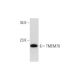 TMEM70 Antibody (G-11) - Western Blotting - Image 297876