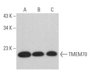 TMEM70 Antibody (G-11) - Western Blotting - Image 368994 