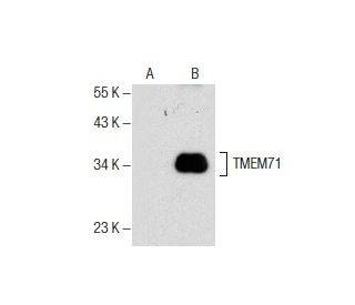 TMEM71 Antibody (B-9) - Western Blotting - Image 157564 