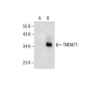 TMEM71 Antibody (F-3) - Western Blotting - Image 155068