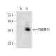 TMEM71 Antibody (F-3) - Western Blotting - Image 155068