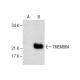 TMEM86A Antibody (F-1) - Western Blotting - Image 287804
