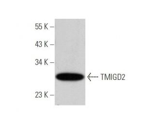 TMIGD2 Antibody (H-5) - Western Blotting - Image 350828