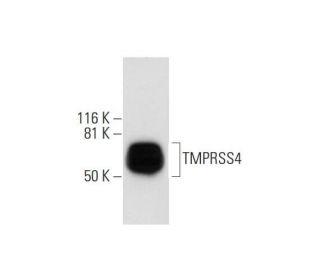 TMPRSS4 Antibody (D-1) - Western Blotting - Image 290970
