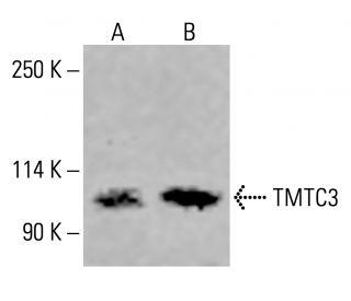 TMTC3 Antibody (G-9) - Western Blotting - Image 415374The Double Nickase Plasmid features a U6 promoter for sgRNA expression, a 20 nt targeting sequence, and a gRNA scaffold to guide Cas9n. It includes a CBh promoter for Cas9n (D10A) and puromycin resistance, GFP for transfection verification, and nuclear localization signals (NLS). The 2A peptide allows co-expression of Cas9n and Puro from a single promoter, enabling precise genome editing with reduced off-target effects.