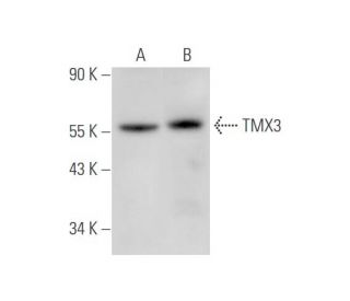 TMX3 Antibody (G-5) - Western Blotting - Image 344616 