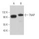 TNAP Antibody (3H414) - Western Blotting - Image 363026