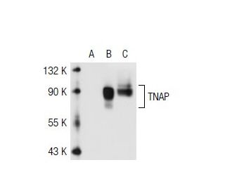 TNAP Antibody (3H415) - Western Blotting - Image 40208 