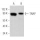 TNAP Antibody (3H415) - Western Blotting - Image 363025