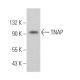 TNAP Antibody (B4-78) - Western Blotting - Image 368405