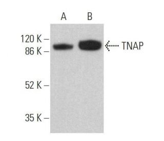 western blotting image from recommended TNAP (TRA-2-39) monoclonal antibody replacement. Image 359715